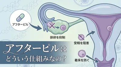 アフターピルはどういう仕組みなの?